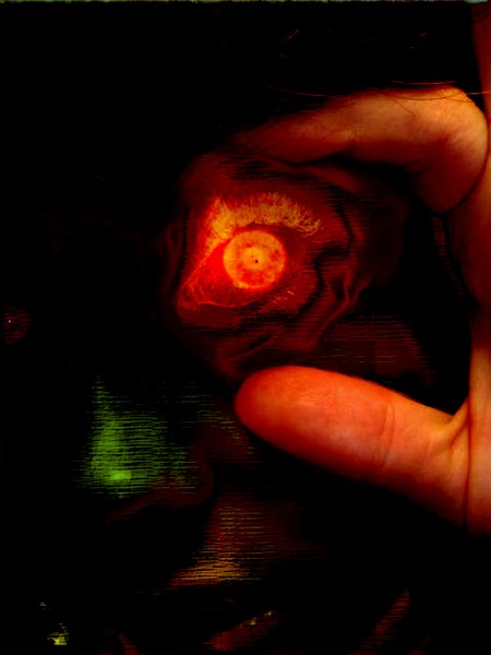 Rosen Eye