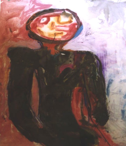 Boy with Red Face