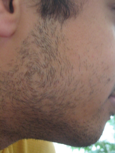 Thumb print beard