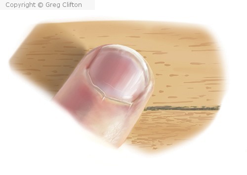 Fingertip study