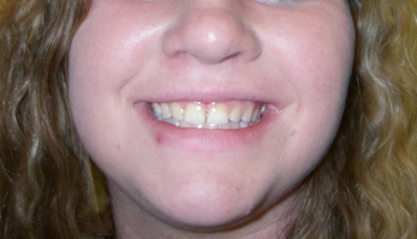 Smile