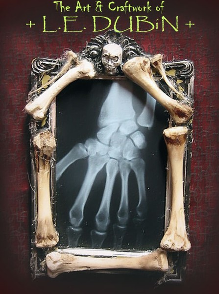 X-RAY HAND BONES