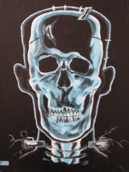 x raystein