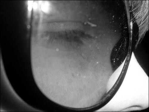 glass eye