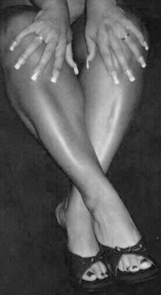 Butterfly Legs