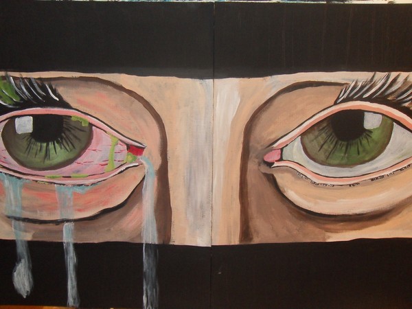 pink eye