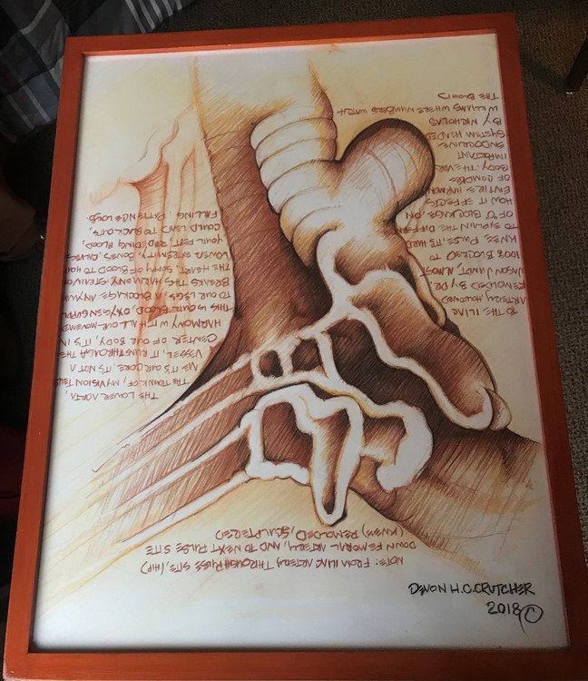 Aorta framed (2)
