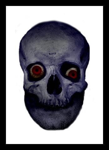 Joined Skull