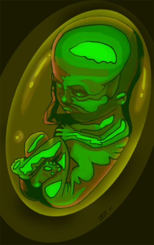 Pilfetus