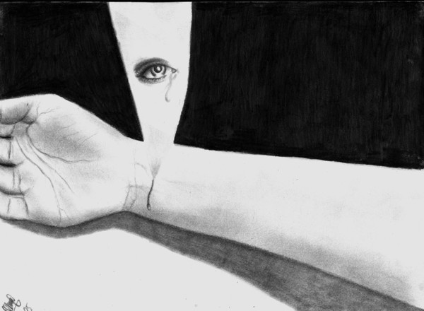 Every story has scars