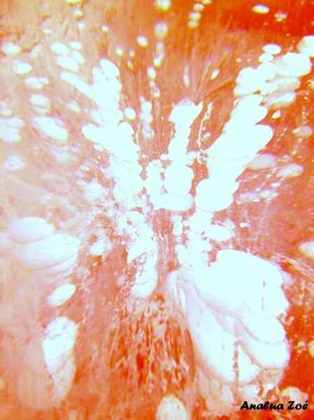 ICE EXPLOSION