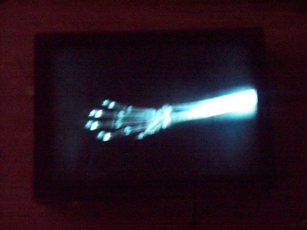 PAW 1 (PIC 3)