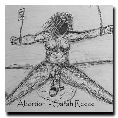 Abortion