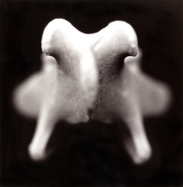 BONE ABSTRACT