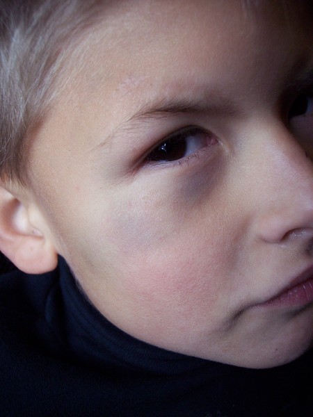Black Eyed Pea
