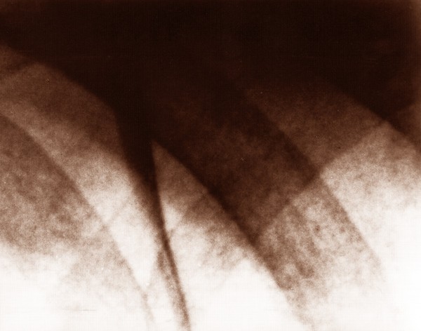 abstract