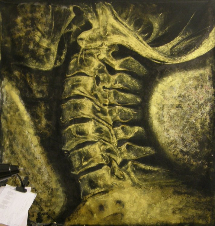 X-ray