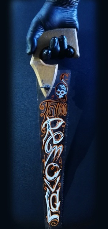 tattoo remuval