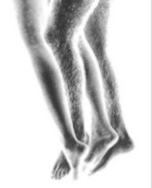 Legs