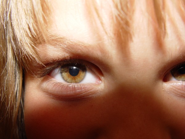 Eye 
