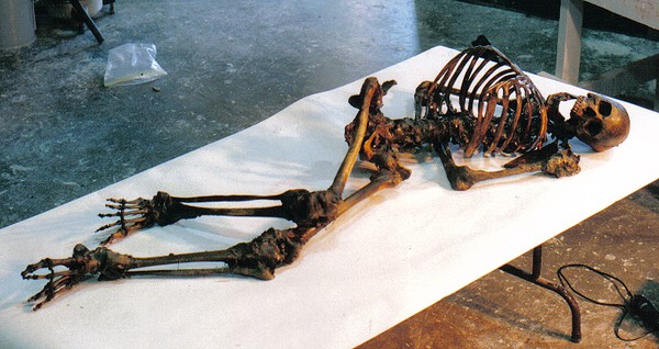 Skeleton