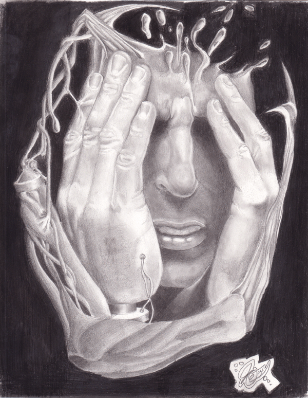 Migraine
