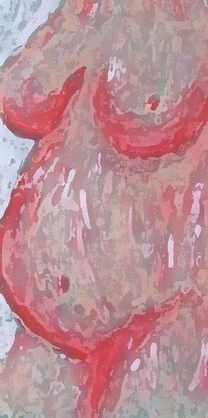 Pregnant