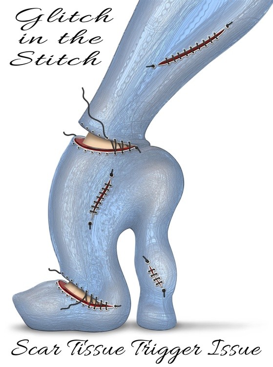 Glitch In The Stitch