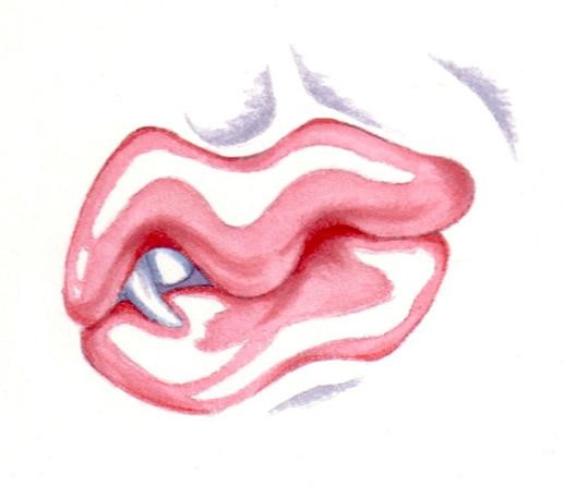 Blood Kiss I