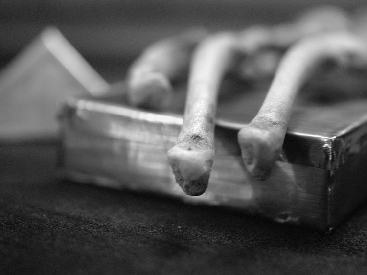 The Bone Box