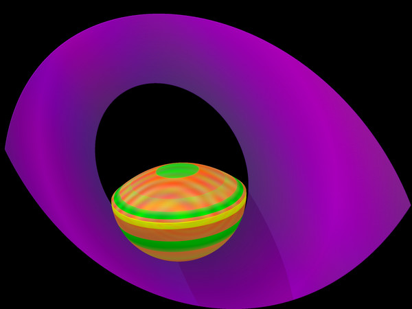 Eye, I