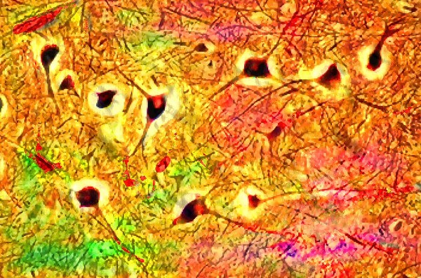 Brain Forest