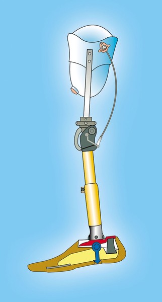 Artificial leg