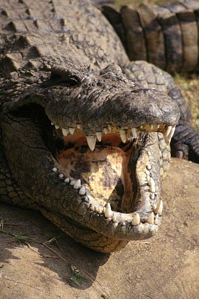 Dental nightmare 
