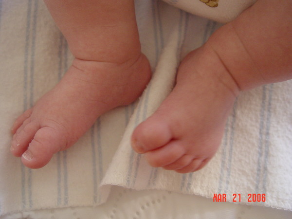 Little Toes