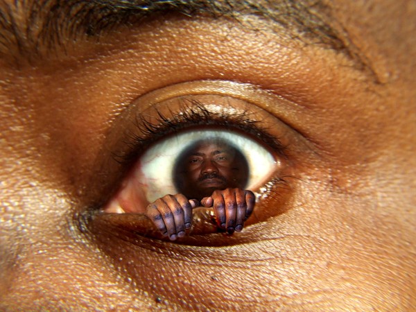 Out of Your Eye.