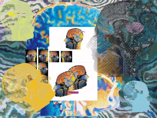 IRRADIAÇÃO VIA CORTEX