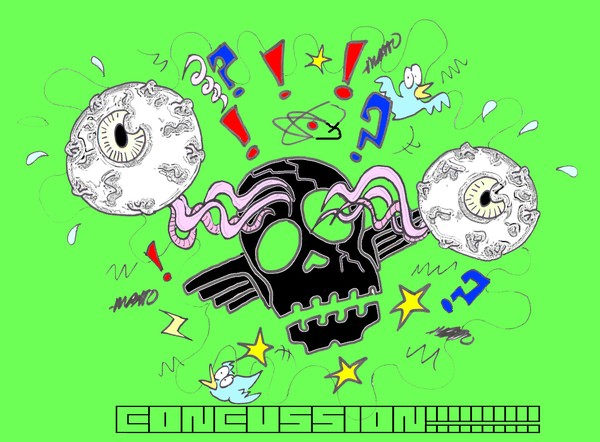 Mild CONCUSSION!!!!!