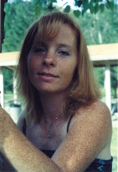 Freckles