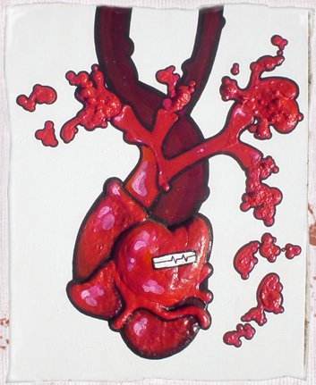 Pacemaker 