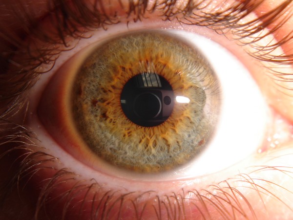 My Little Eye