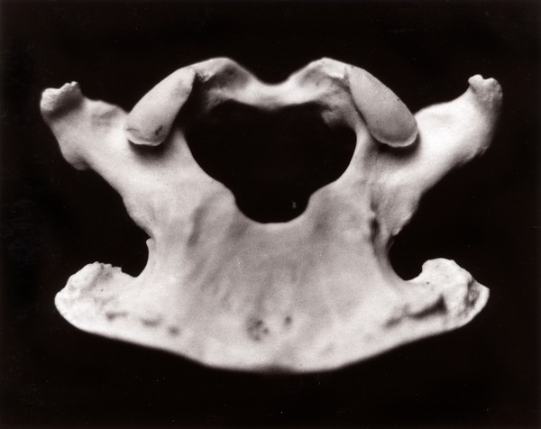 Bone abstract #3