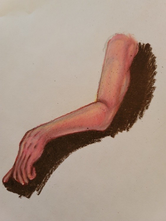 Arm