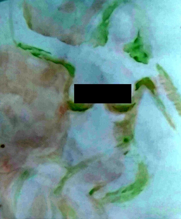 Leigh Cropped Arm Up Watercolor