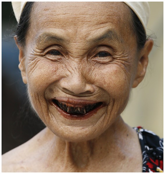 Black Tooth