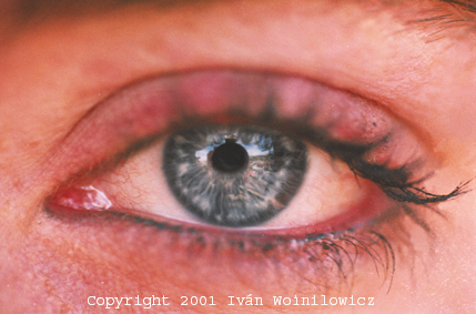 Blue Eye