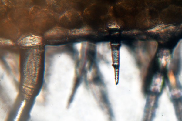 Plant Hair Through a Microscope