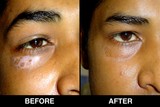by Skin Laser Centre