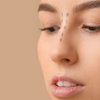 Rhinoplasty in Islamabad)